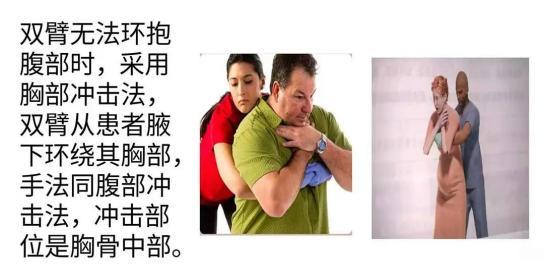 救在身边"志愿服务项目—心脏骤停救生技术 气道异物梗阻急救法