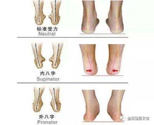 用外八字的方式跑步,这种方式使得脚掌在落地的过程中不自觉地向外撇