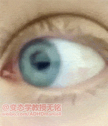 眼睛其实像果冻一样软~~~(gif 2mb)