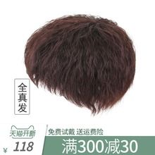 玉米烫头顶补发片