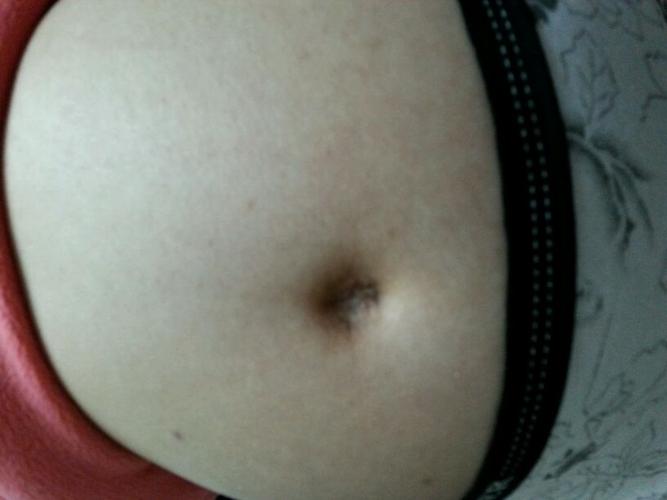 看孕妈肚脐眼知男女