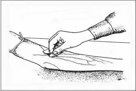 护士必看,七种最难穿刺静脉的处理方法!