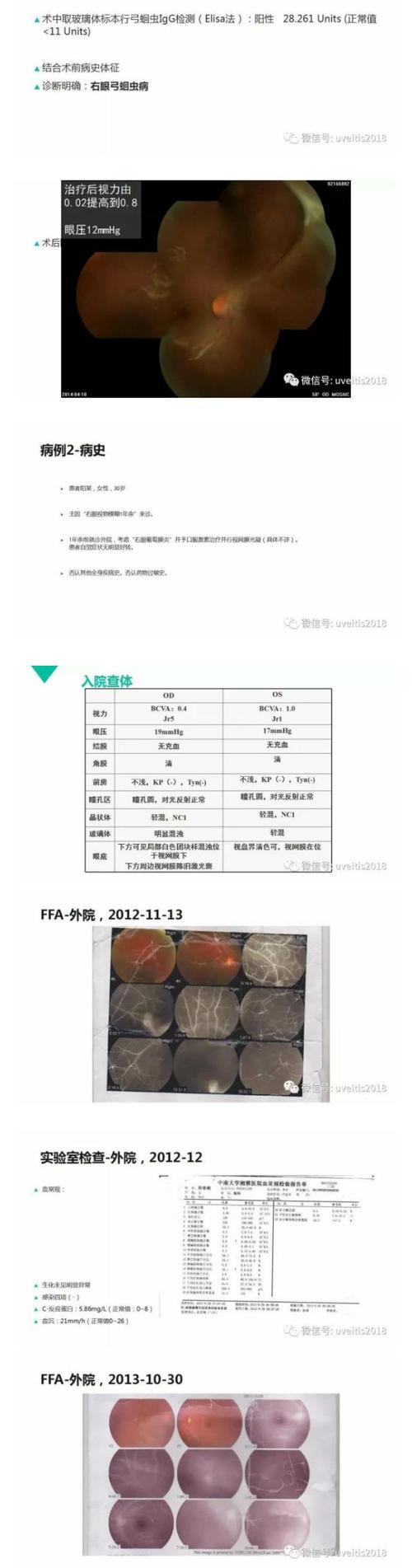 > 眼弓蛔虫病(附音频)