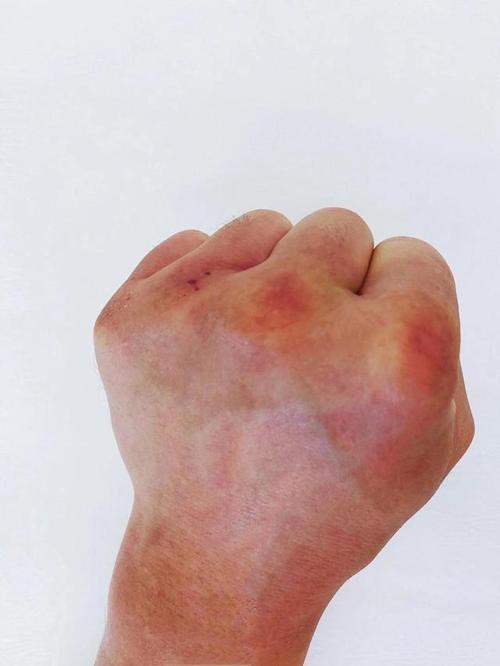 武僧一龙疯狂备战将拳头打肿,三番战有望速杀泰拳王