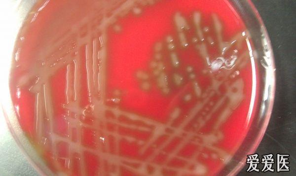 楼主乐园2011-10-26 01:34:03   标本来源:血培养瓶报阳后转种