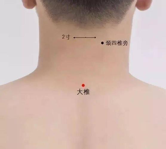 1,大椎穴