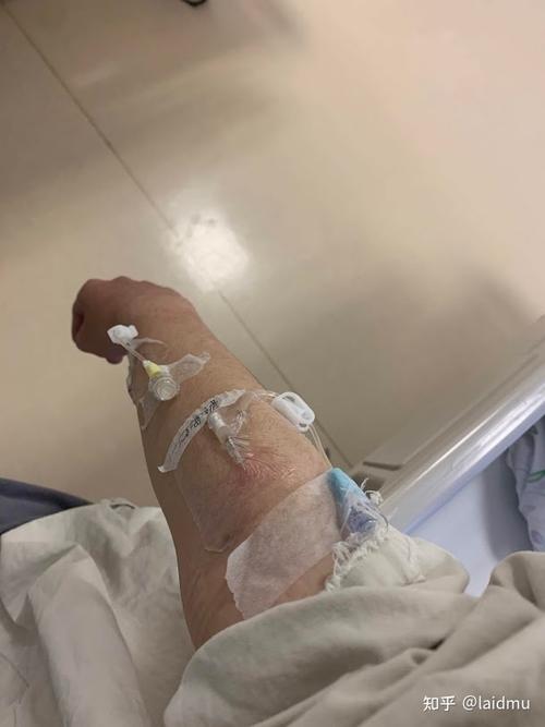 我的突发性耳聋耳鸣医院没有治好但是我自愈了可能是靠自己的治疗