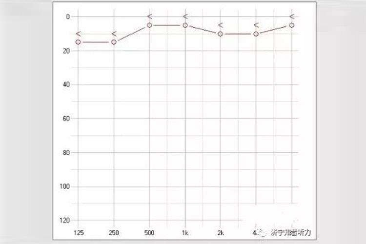 临床上正常听力的听力图显示为:骨导听力在