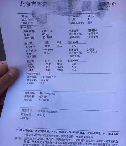 孕妈妈不要闻唐筛色变,它并没有想象中那么吓人