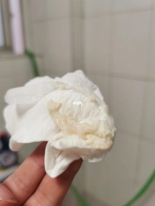 排出来这么多豆腐渣严重吗?_妇科病_妇科_医疗健康