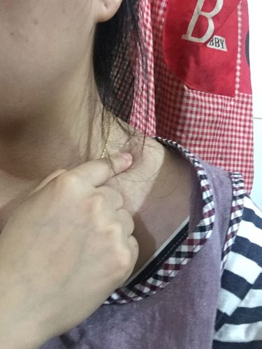 锁骨上有个硬硬的东西,是淋巴结吗?