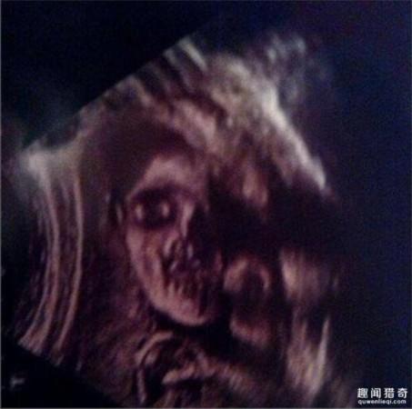 准妈妈去体检,看到b超下的婴儿差点吓哭!
