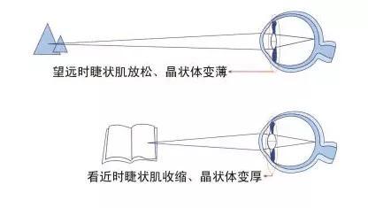 孩子近视问题全解答!