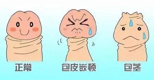 包皮过长,包茎让男人女人都伤不起