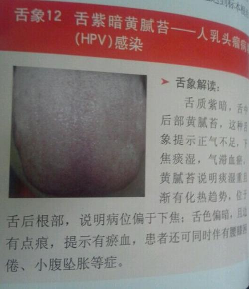 平时体虚,情绪欠佳,            同时伴有腰膝困倦,小腹坠胀等症状.