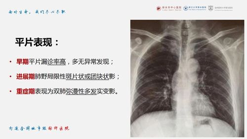 新冠肺炎ct早期征象与临床基础及鉴别诊断