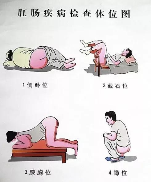 "在美国看痔疮"笑出内伤!