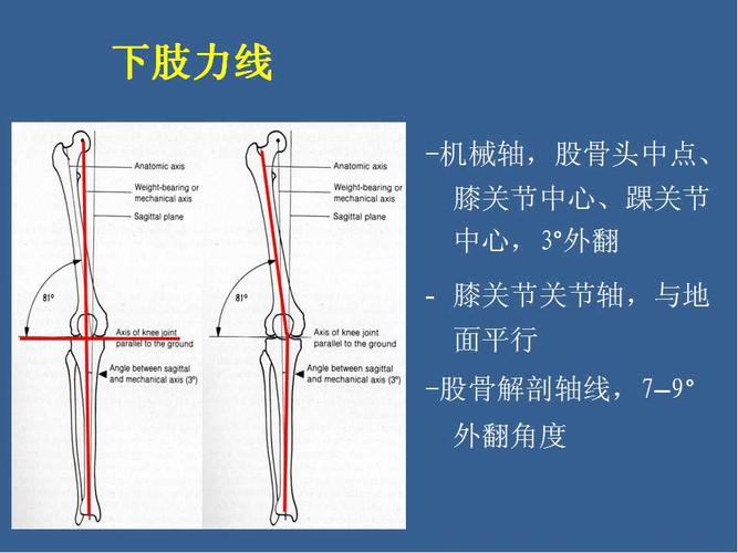 股骨远端骨折