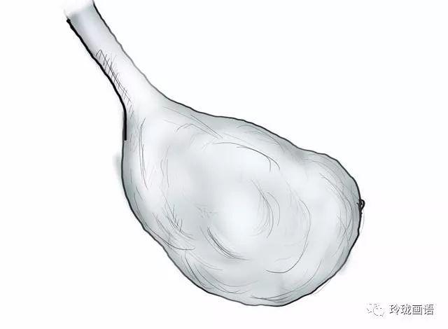 教你看懂妇科b超报告超级干货来啦