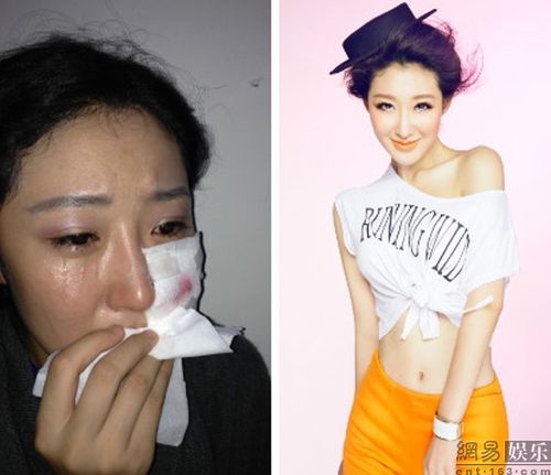 高清:李依馨被狗咬毁容疑炒作 网曝去年也被咬