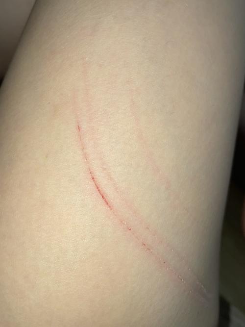 睡一半被猫抓伤脸