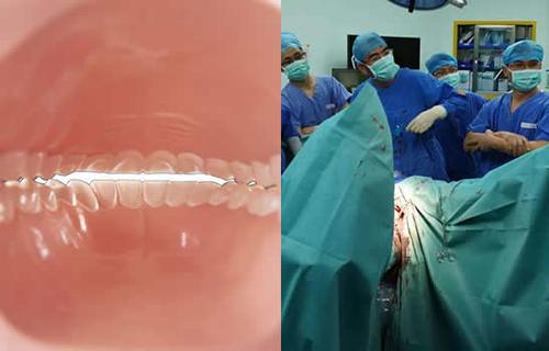 什么是石女呀石女是什么样子图片