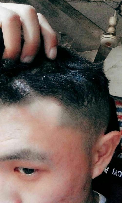 头发全贴头皮弄不了了怎么办弄了35分钟左右才洗掉的,事后才清楚男生