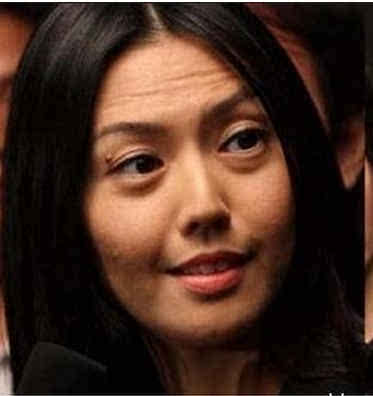 由于青春其护"痘"不佳,导致孙燕姿脸上坑坑洼洼,即便化妆都无法遮盖掉