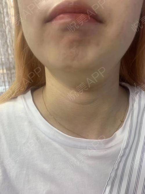 爱尔菲琳