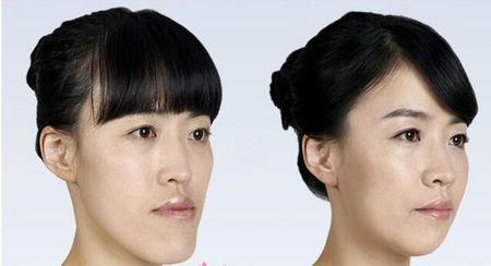 俗话说的"地包天"是什么意思?