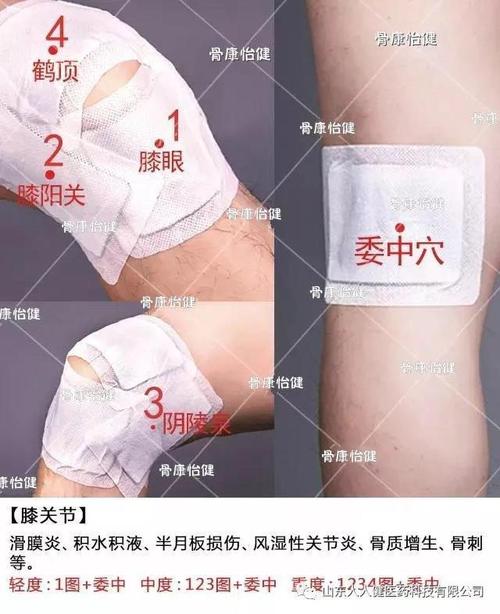 传统黑膏药/骨康怡健冷敷贴使用方法 真人贴敷图