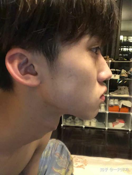 侧脸丑而正脸好看是一种什么体验?