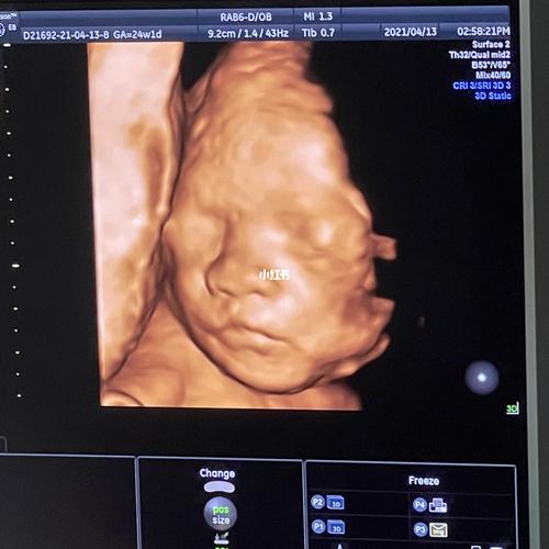 宝宝24周的四维照出来啦~_四维彩超_四维彩超照_母婴_孕产经验