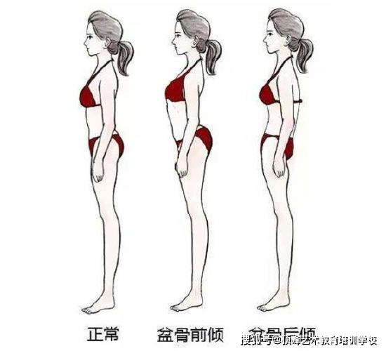 膝盖超伸,骨盆前倾,骨盆后倾,腿型不正,高低肩,脊柱侧弯等都是不良