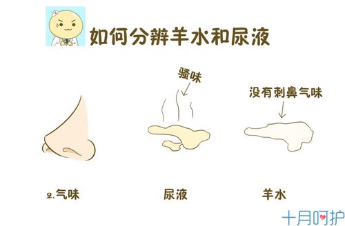 羊水早破vs尿液,傻傻分不清楚