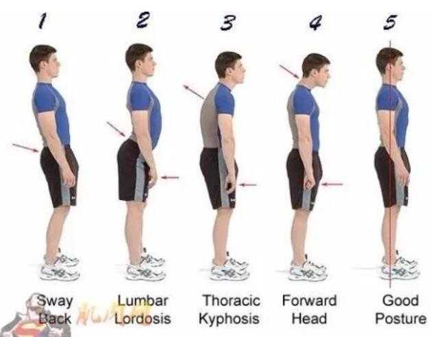 (关于弓背和站直的对比图)