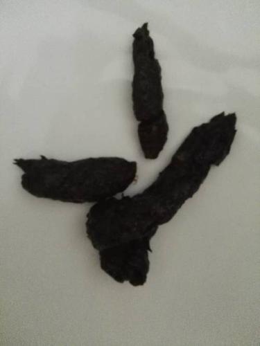 我这个是不是黑便?我昨天和前天喝了桑椹水 今天有点