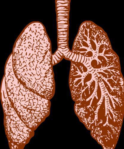 而让纤维化的肺部恢复正常,类似于让煮熟的肉变回去,根本是不可能的事