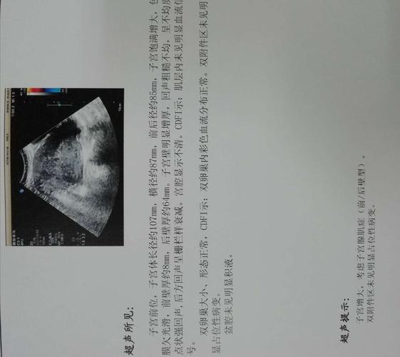 子宫腺肌症,b超示:子宫呈前位