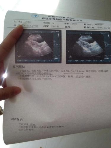 莫如尽   2016-04-05 21:30 怀孕知识 知识排行