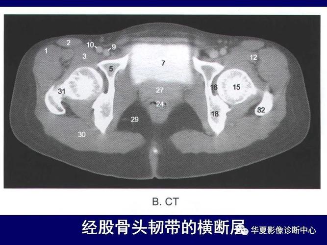 最全的下肢mri 解剖