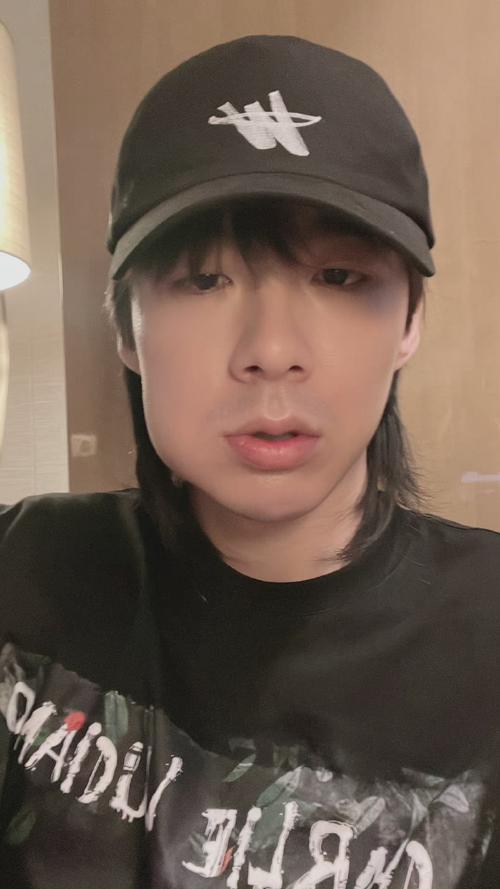 刘宇宁说自己脸肿的夸张了