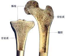 骨松质损伤指密质质地致密不易损伤,而松质质地稀疏,呈海绵体状易