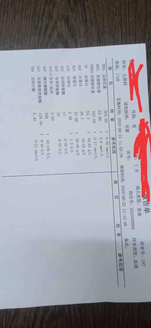 新生婴儿黄疸,出生第三天黄胆开始黄,照蓝光2天,黄渐渐退,就出院了