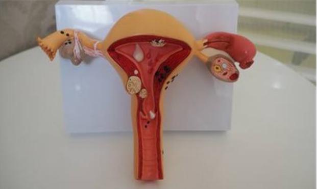 女性很伤卵巢的几种"行为",别不在意,当心婚后难孕