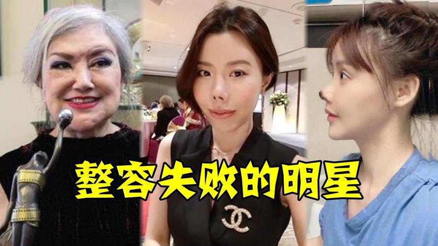 整容失败的十位明星,高溜鼻头感染变考拉,第七位2800万整成女鬼