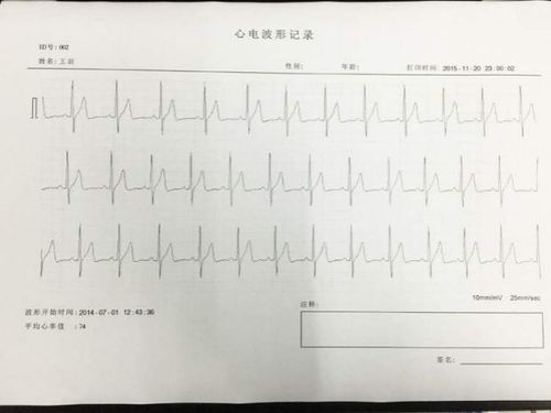 力康180b快速动态心电图机心电检测仪心电监护仪监测心率ecg心律
