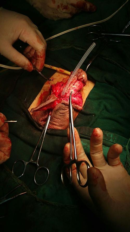 2018年7月份38台尿道手术