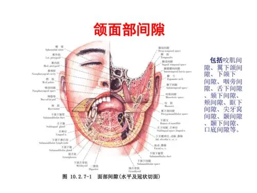 发展成严重的颌面部多间隙感染,继而危及孕妇和胎儿的生命