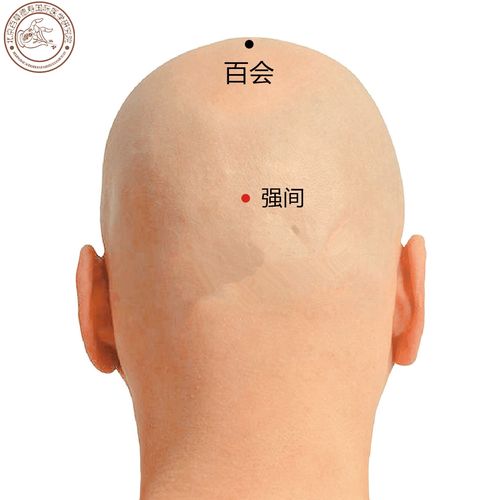 百会